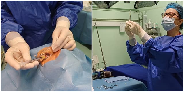  Tratamentul de Precizie pentru Salvarea Vederii: Injecțiile Oculare Gratuite de la Spitalul CFR Timișoara Care Îți Pot Schimba Viața!